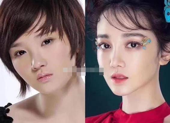 整容最成功4位女星钟楚曦没想到最后一位不说绝对看不出