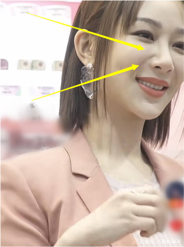 原创杨紫被怼脸拍无美颜下鼻子凸痕太抢镜这变美的代价太大了