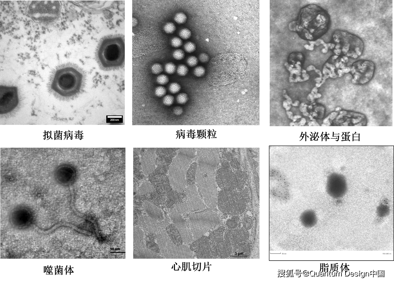 透射电镜观察生物样品,负染是必须的吗?_成像_染色_传统