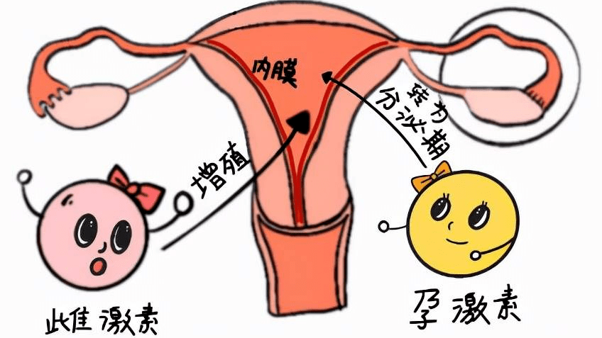 醫德佳腺肌症保宮:腺肌症高發?可能是由這幾點造成._子宮_內膜_雌激素