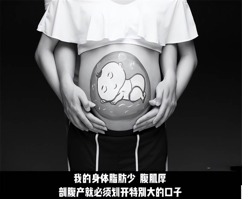 吴敏霞公开生产细节三年经历两次剖腹产肚子上疤痕好明显