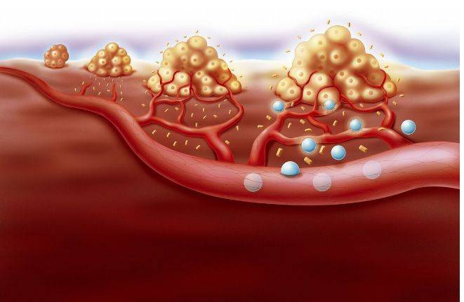 原创重视高血压高血脂那你更应该了解血液粘稠这同样可怕