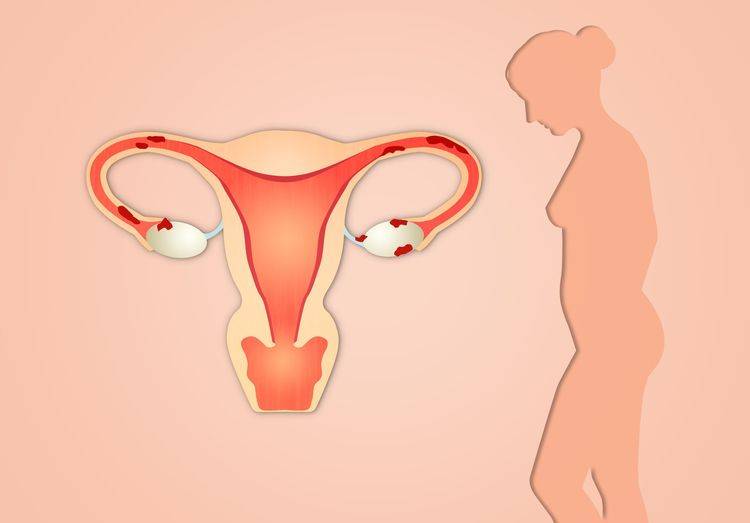 【子宫下垂】子宫下垂的原因_子宫下垂的危害_子宫下垂的预防