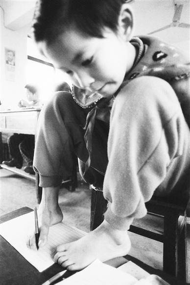 原创断臂女孩雷庆瑶如果美有段位那我一定是最高级的那种