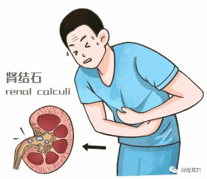 益康耳穴肾结石疼痛无需再忍小白也能轻松帮家里人解决痛苦