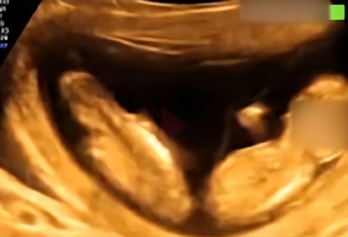 这几天团子妈刷到一个非常有意思的视频,调侃的就是双胞胎在妈妈子宫