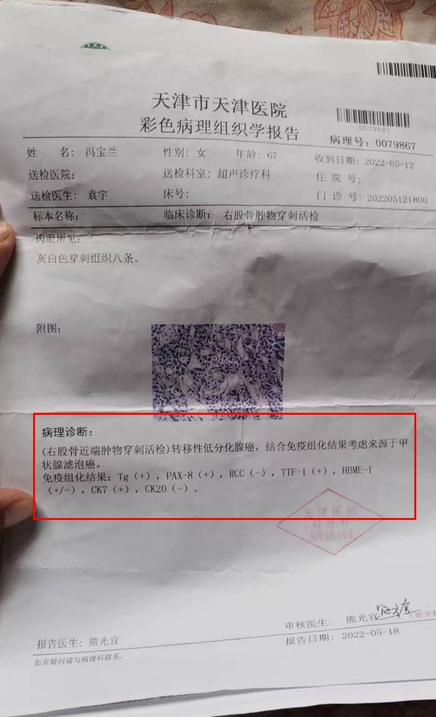 母亲不幸突发甲状腺癌骨转移,手术迫在眉睫,儿子陈少辉无助,渴望大家