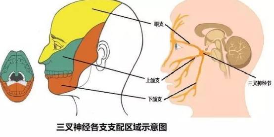 天下第一痛到底有多疼三叉神經痛的症狀表現一覽