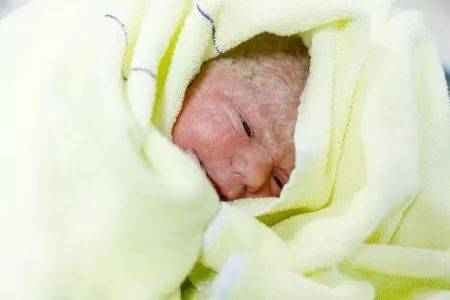刚出生一天的婴儿照片图片