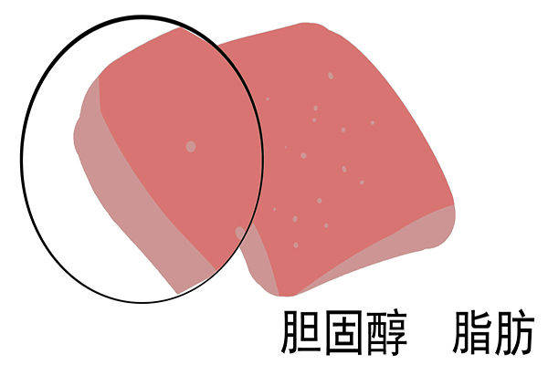 年过50岁，胆固醇高？医生：降固醇期间，3个错误不要犯