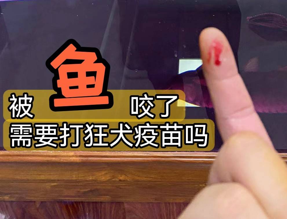 被一条鱼咬出血后金华男子深夜发出灵魂拷问