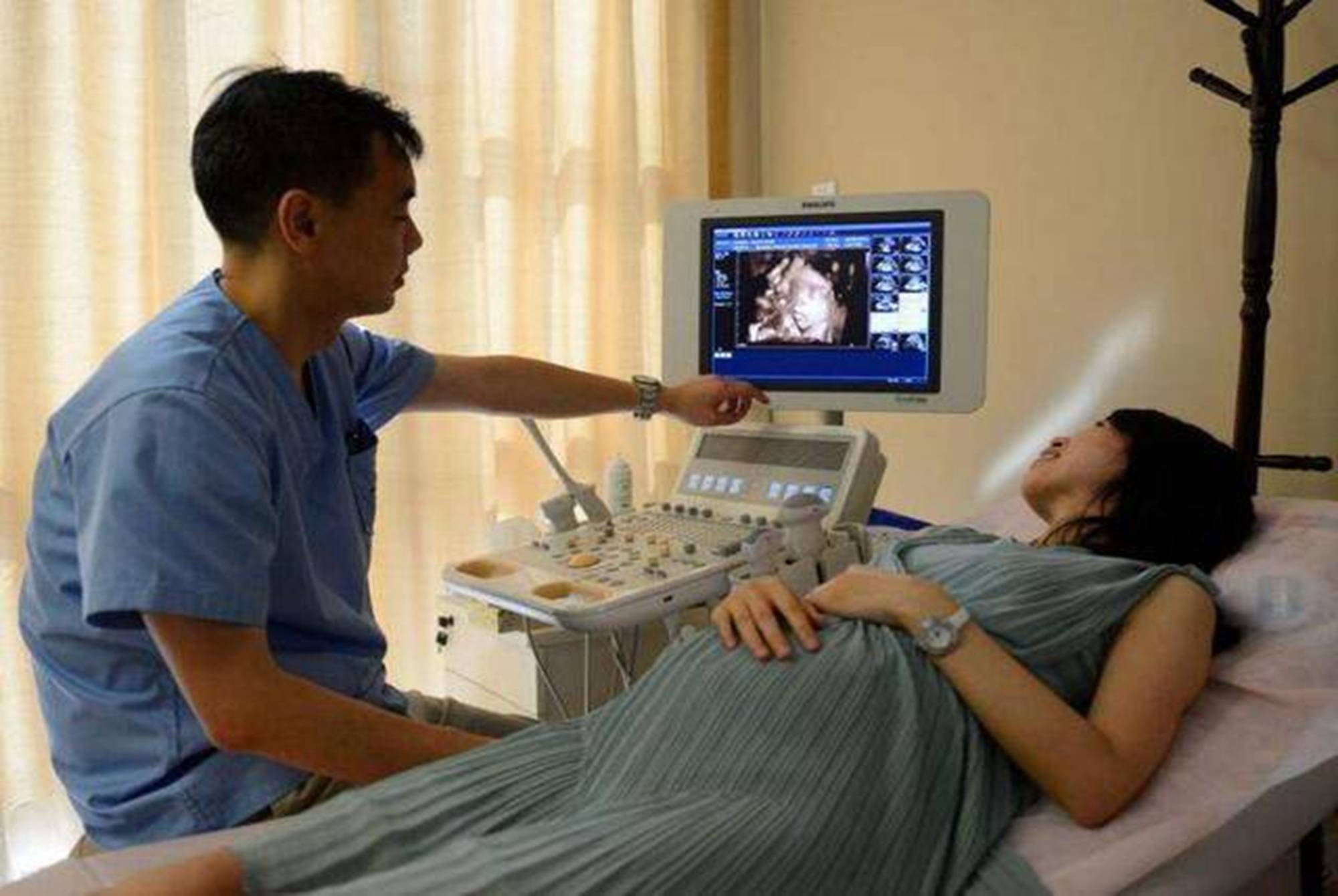 孕11周胎儿图片b超图片