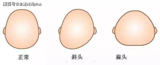 “睡扁头”长大有多毁娃?一张图引网友吐槽:家长别再害娃了_后脑勺_头型_戴帽子