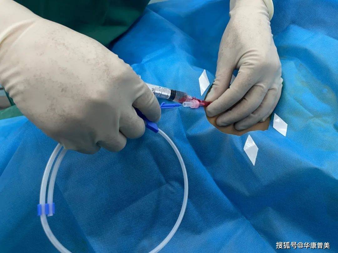 中心静脉穿刺置管术的注意事项还包括以下几方面:第一,穿刺前要详细的