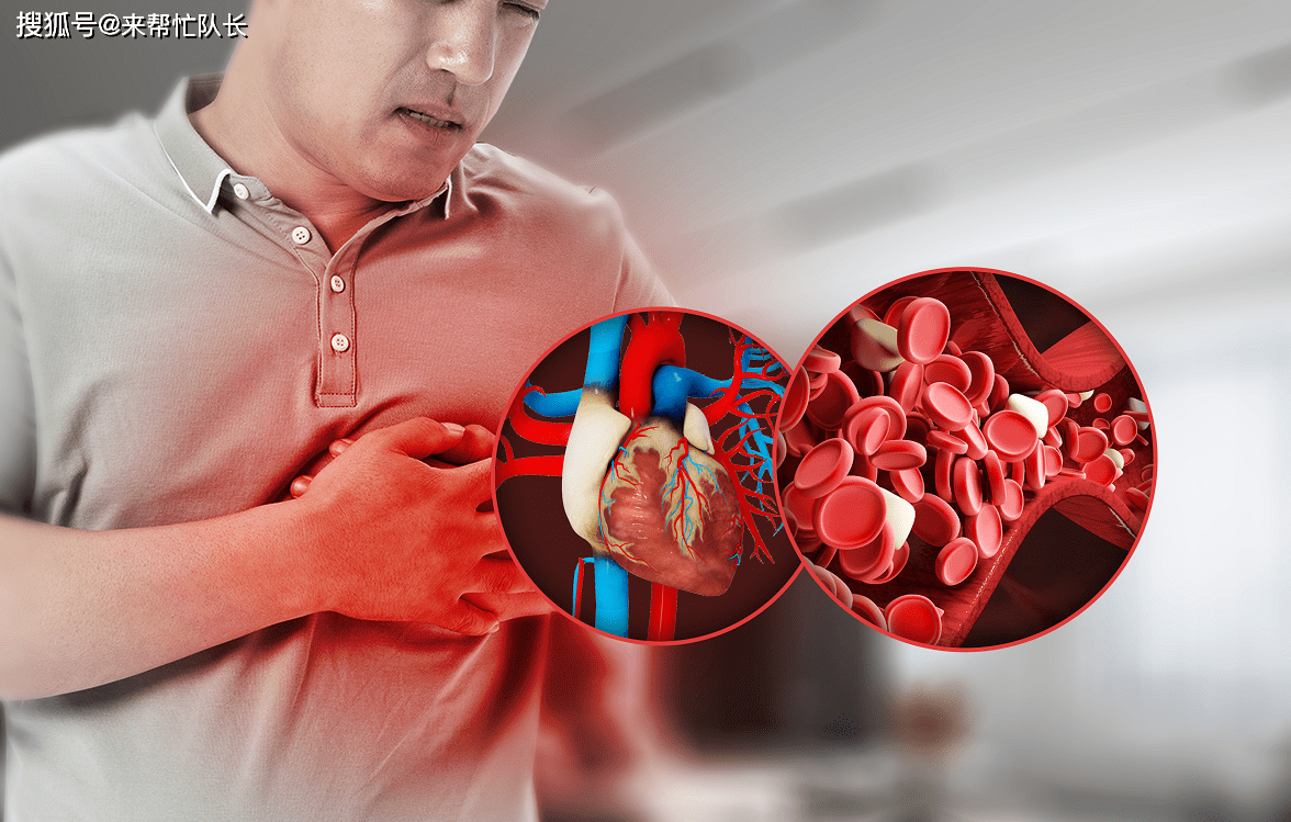 五种常见的心血管疾病图片