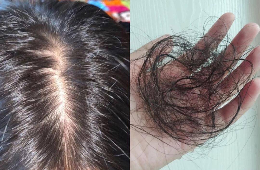 现在改正还不迟_头皮_头发_油脂