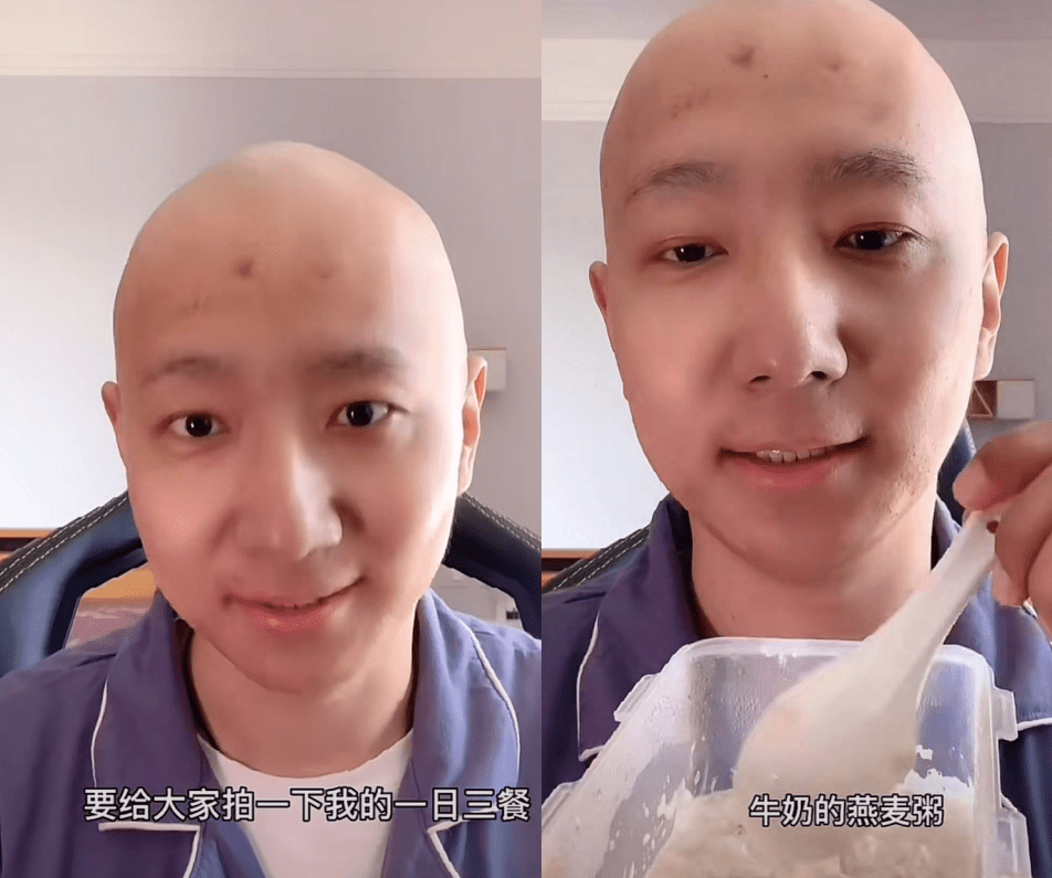 原創知名男星於笑自曝患抑鬱黑眼圈濃重面色憔悴鬍子拉碴病態明顯