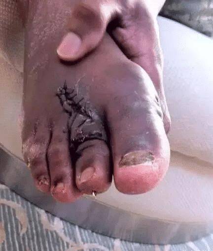 原创nba球星的脚趾奥尼尔最恶心老詹乔治最畸形看到马布里服了