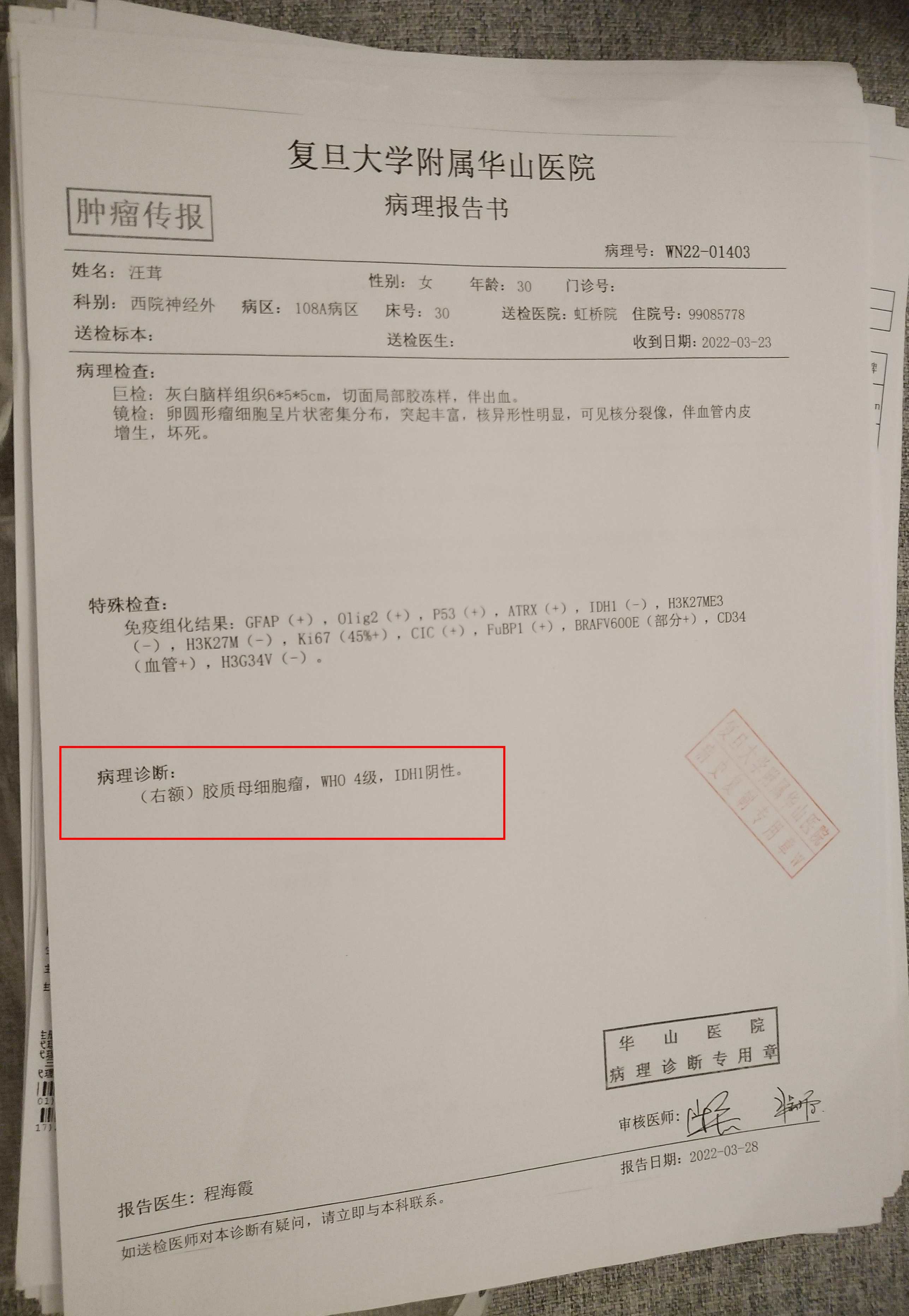 胶质瘤病理报告图片