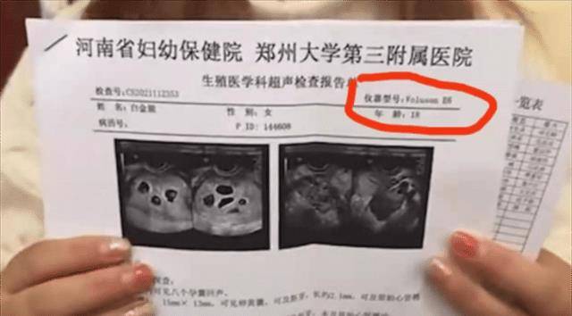 包生男孩!湛江8胞胎"勇往直前"-第1张图片-西安论坛资讯