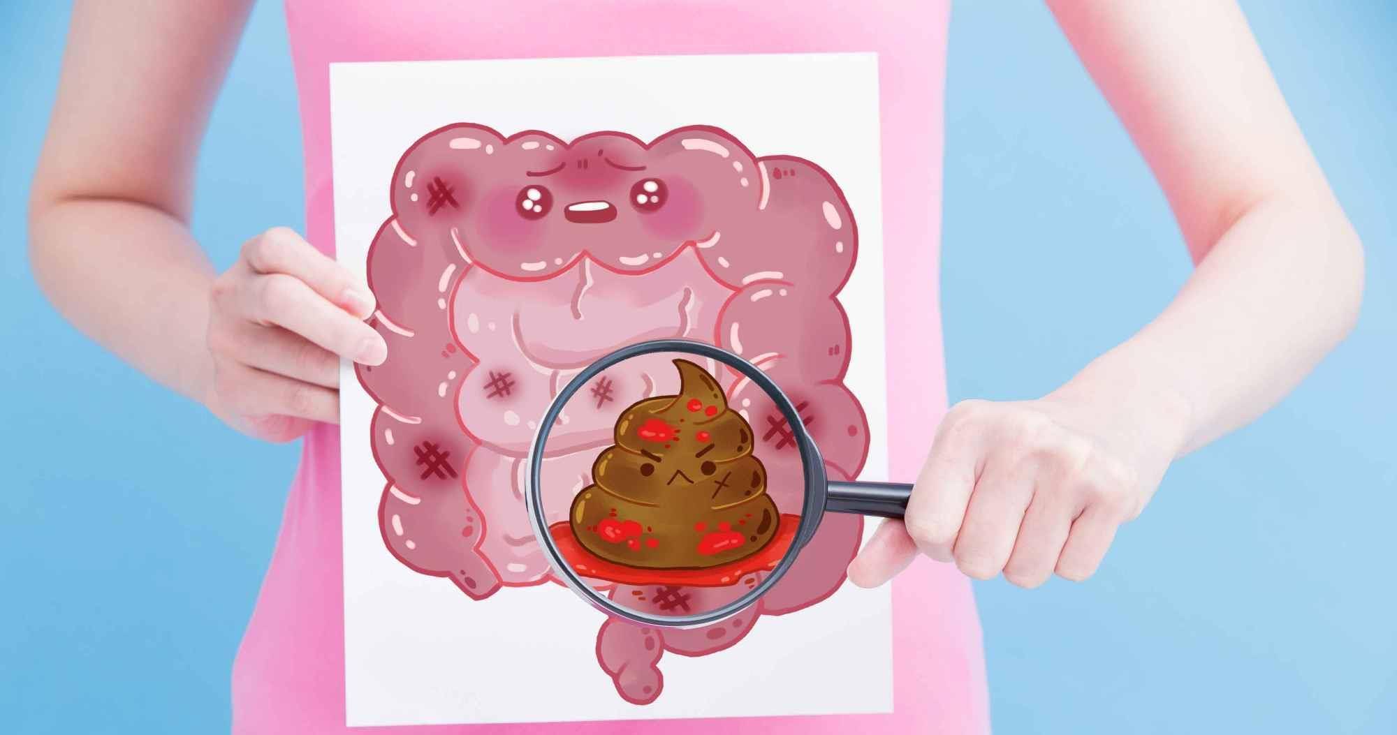 肠道"刮粪机"找到了,若你爱吃,排出黑臭宿便,赶走便秘口臭!