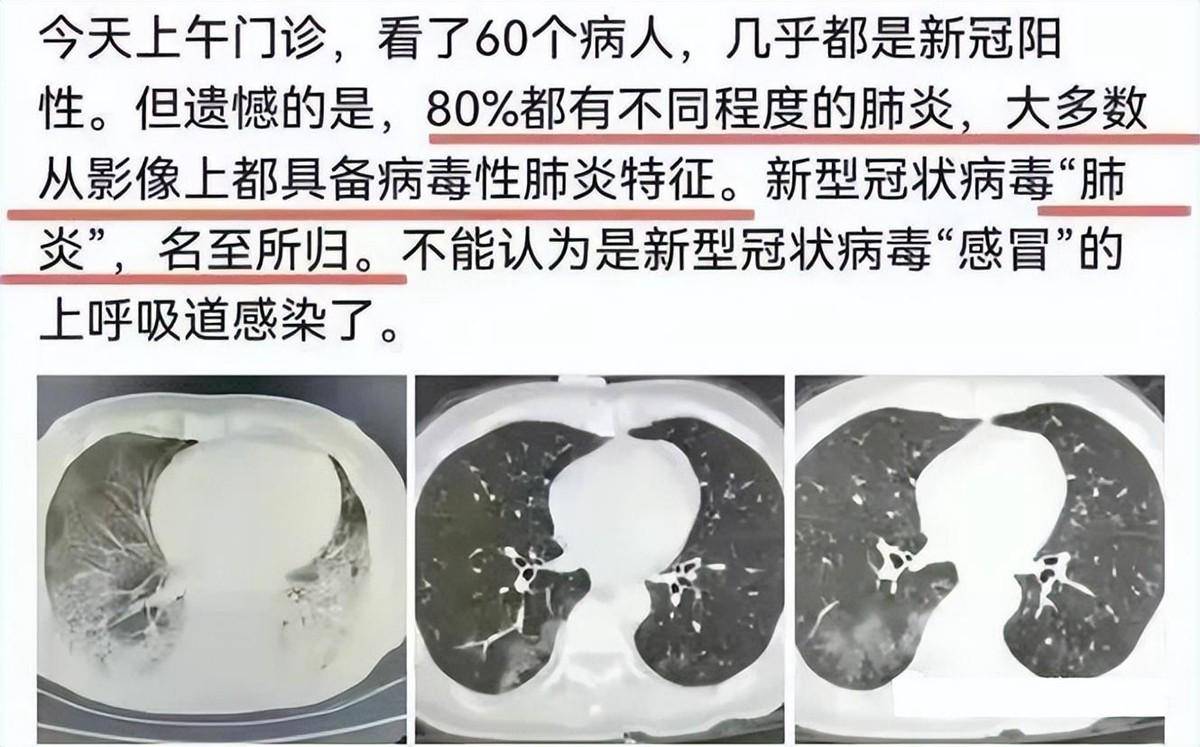 12岁男孩被诊断出白肺,提醒：阳康后出现3种情况,别不当回事