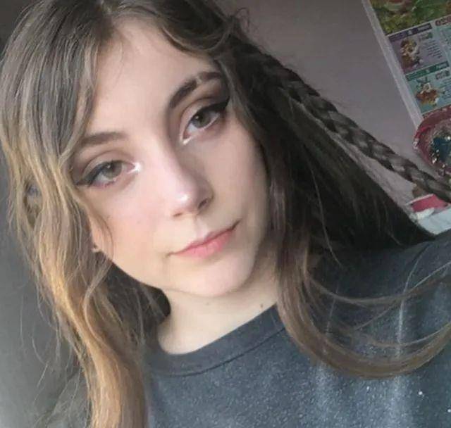 14岁国外妥瑞症美少女,出镜化妆萌翻无数网友,坚强的人不认输_患者