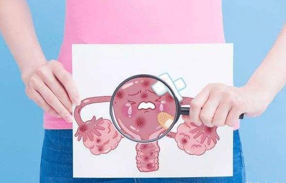 高危hpv病毒若是持续感染,则会引起宫颈病变,导致宫颈癌