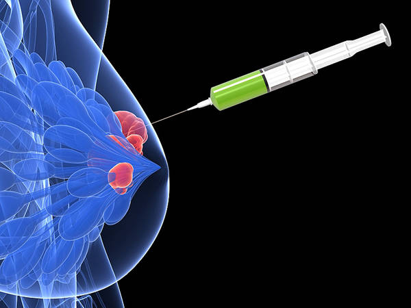 6,乳腺b超 ai超聲與人工智能相結合的檢查方式具有高度的創新性和前瞻