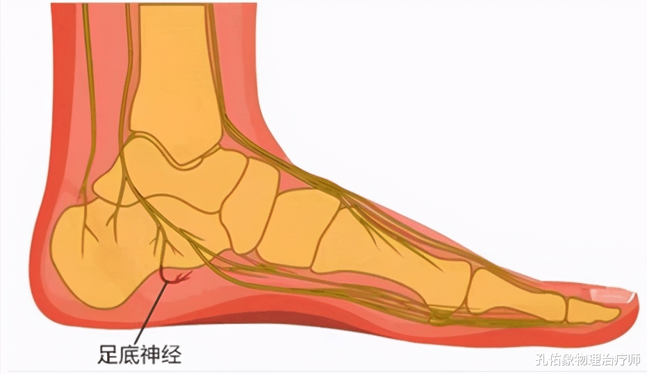 会在内踝偏后方处出现足底外侧神经的卡压,引发跟骨结节内侧前缘的