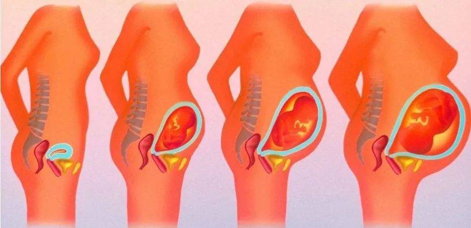 慈溪艾博尔科普:盆底肌损伤不可忽视_康复_活动_情况