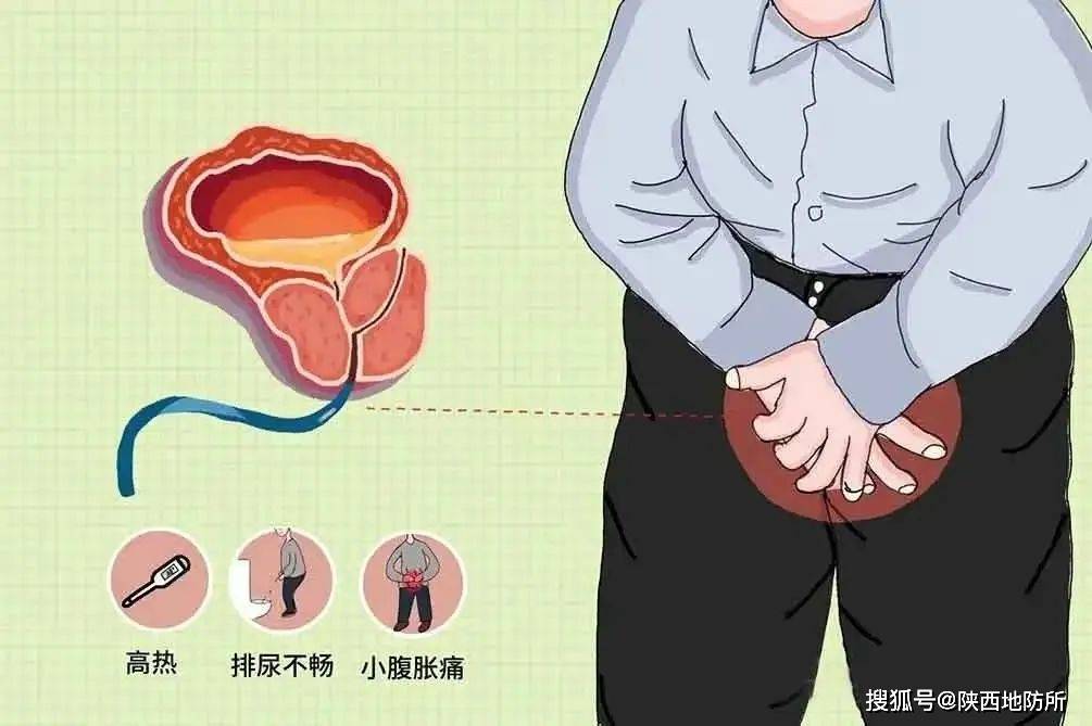 前列腺炎龟头症状图片图片