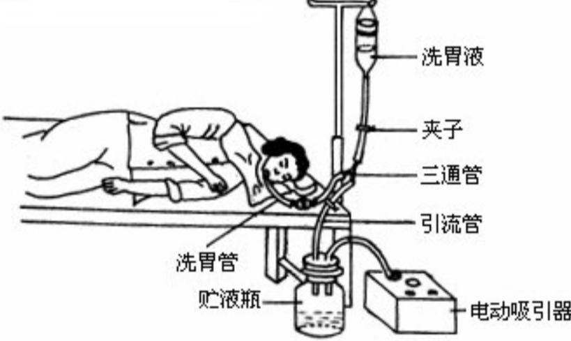 电动吸引器连接图解图片