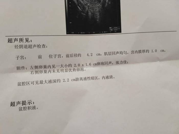 乳腺增生、子宫肌瘤……女性这4个身体异常,要不要治得这样判断