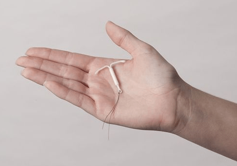 曼月乐能避孕更能治病_子宫_内膜_乐环