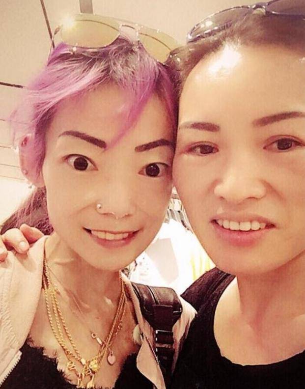 伍智恒:嫁入豪门8年瘦到只剩44斤,做了20次手术,却被扫地出门_郭永