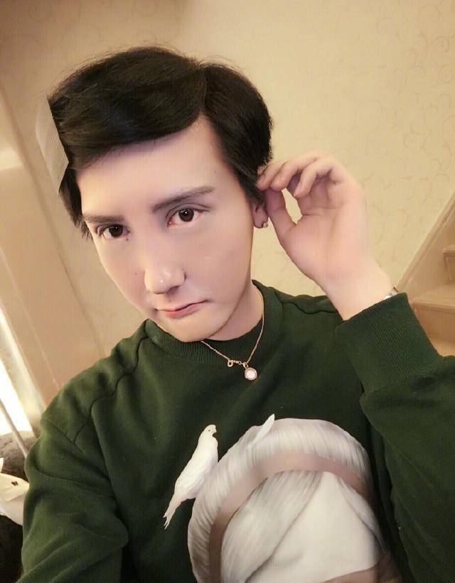 刘梓晨融掉玻尿酸脸垮了,补打了80针后长这样_芭比_样子_什么