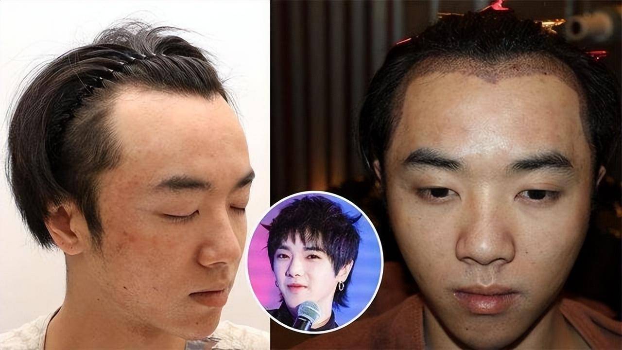 从长相平平到帅气迷人,这几位男星整容前后差距大,有你偶像吗?