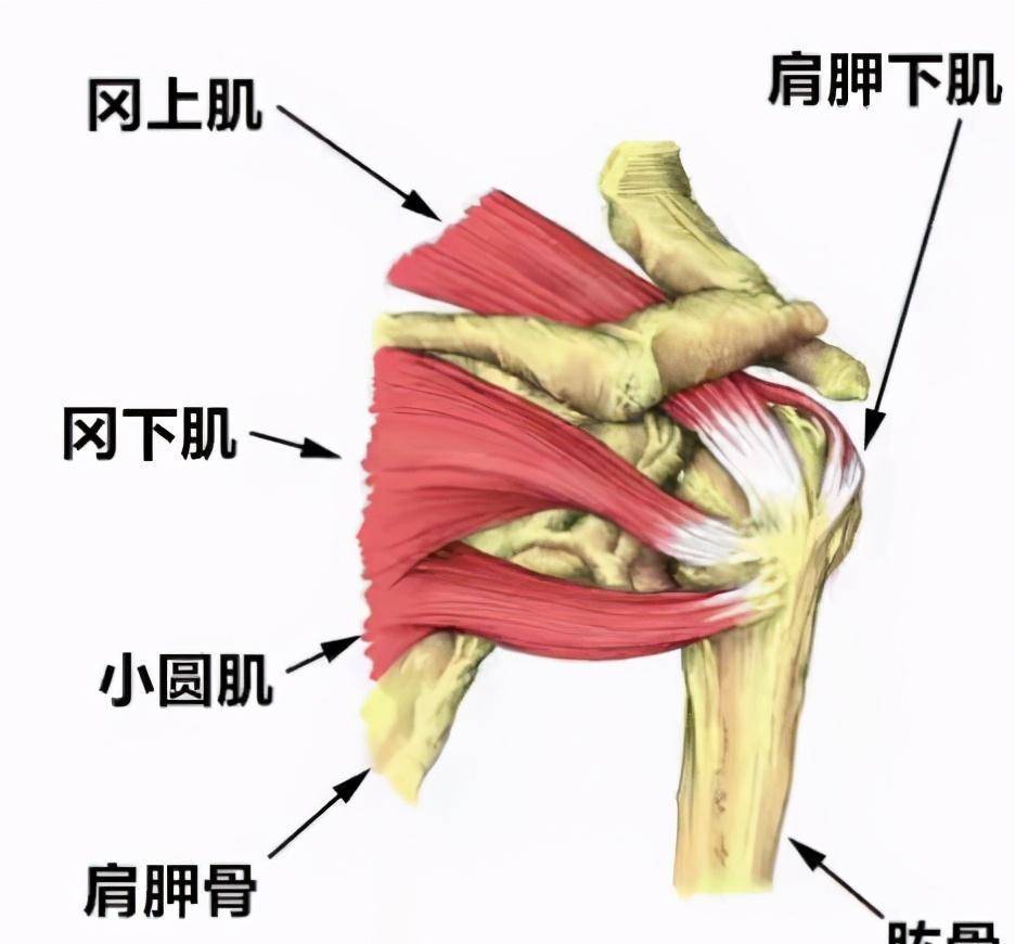 右肩冈上肌腱撕裂图片图片