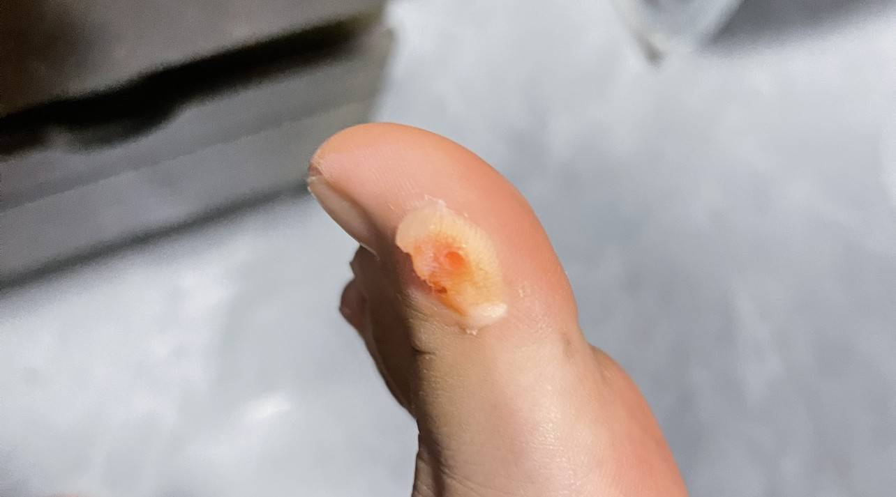 买回来,问了下两朋友,他们直接让我拍照给人家的清初集,说每个人的