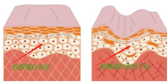 胶原蛋白肽是智商税吗，胶原蛋白哪个牌子好呢？