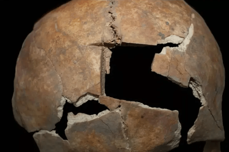 “头骨”考古新发现三千年前人类已开始尝试复杂开颅手术