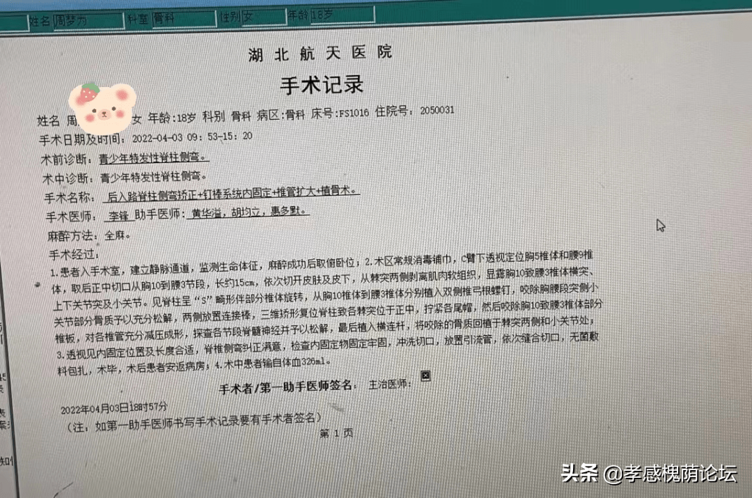 5小时脊柱侧弯矫正术,18岁"驼背"女孩挺直胸膛_小周_手术_胡均