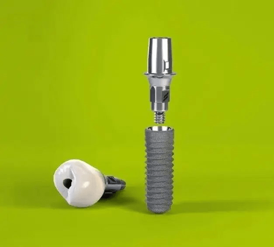 世界十大种植体品牌盘点_寿命_缺点_参考价