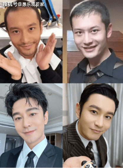 黄晓明头发忽多忽少,是植发还是假发套?