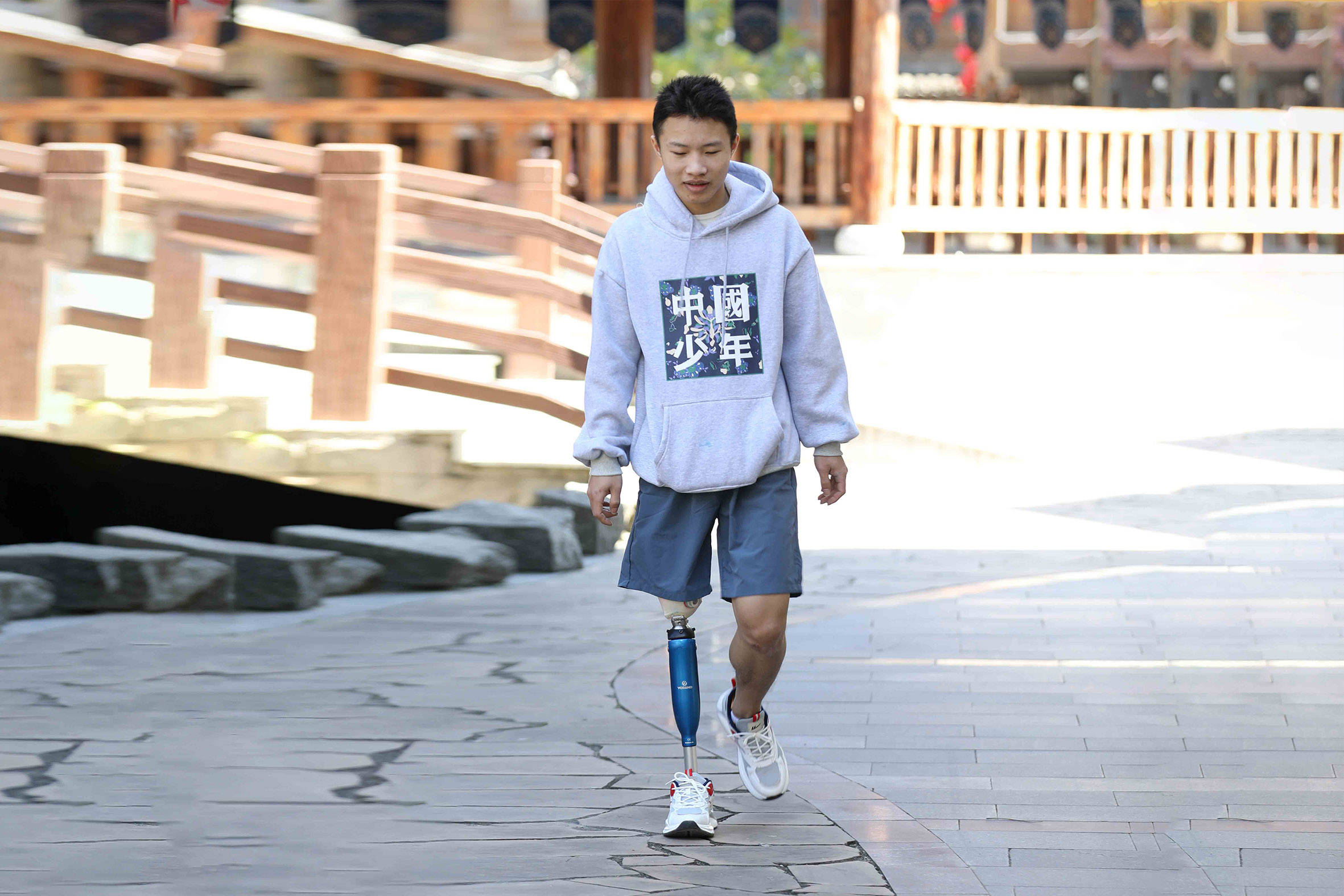 假肢价格详解：了解行业的最新动态