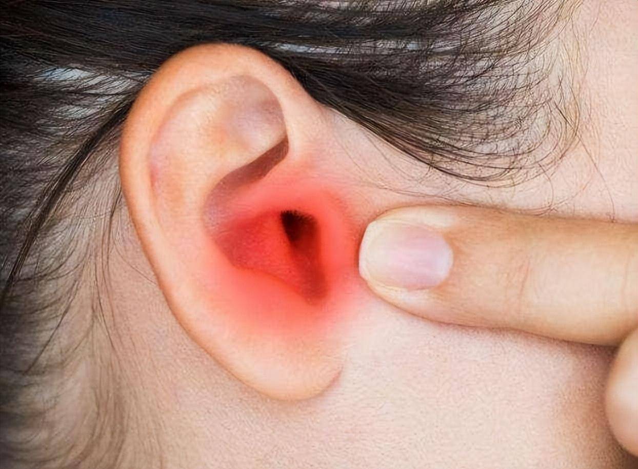 造成耳屎过多,进而出现耵聍栓塞,引起继发性的外耳道炎,引起耳朵瘙痒