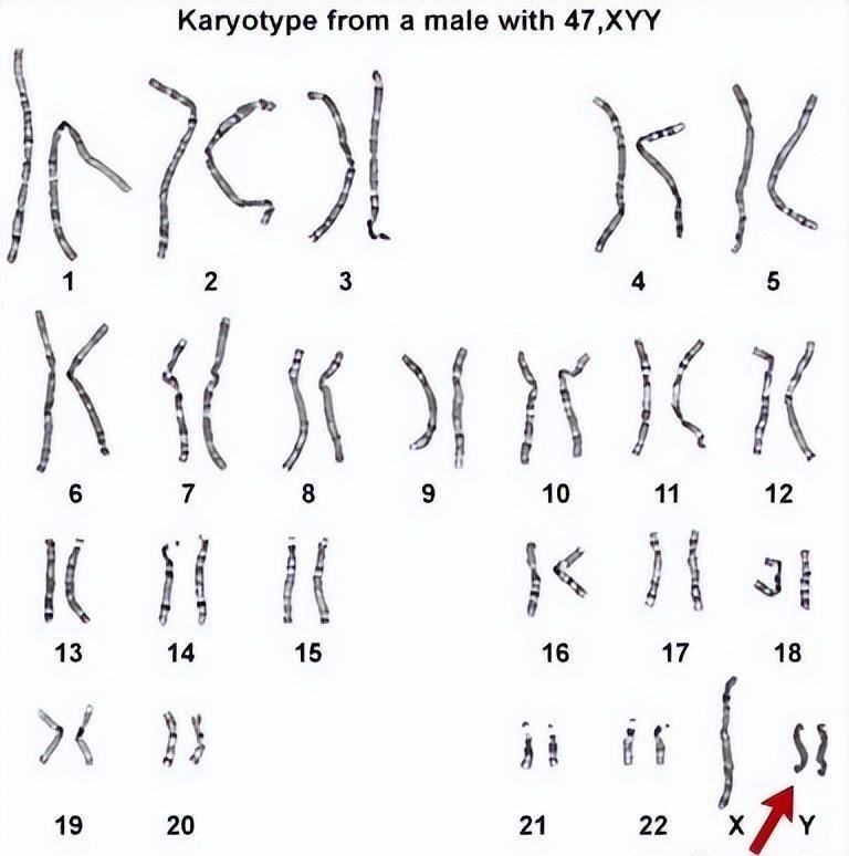 男性染色体检查报告单图片