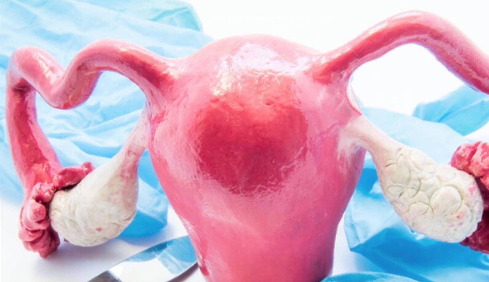 女生别再疏忽大意了_阴道_生育_卵巢