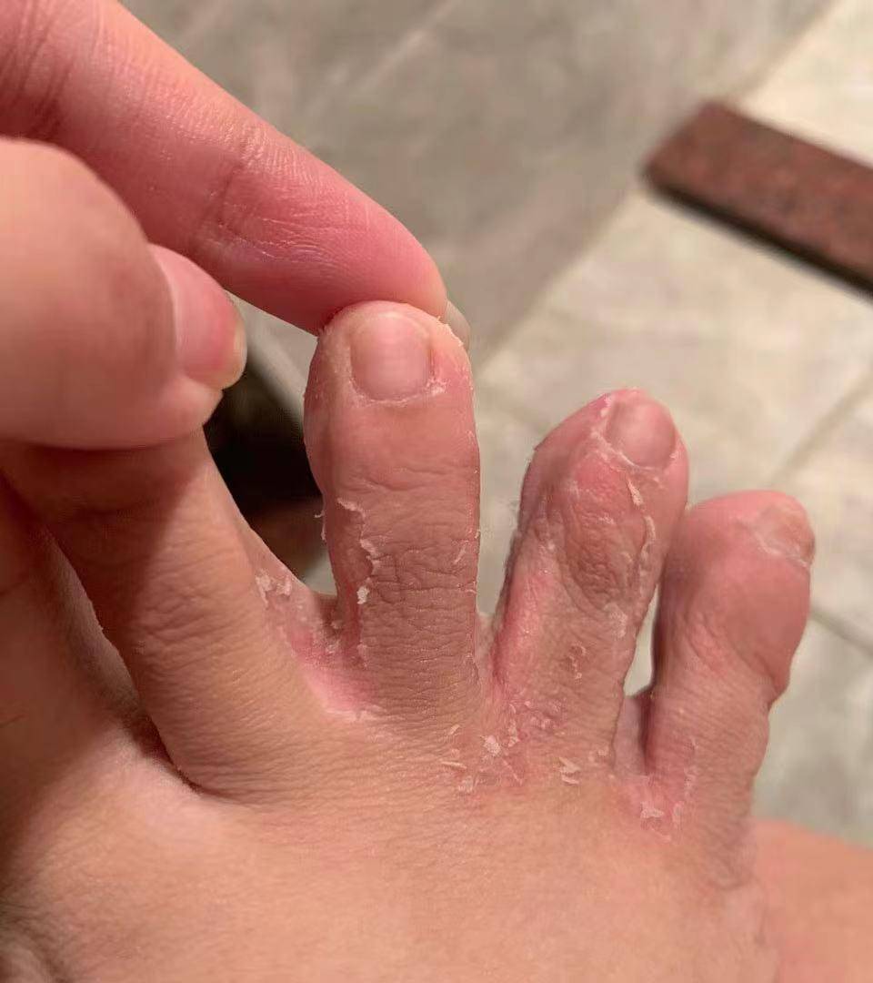 中招了不知道怎么办?这个25天根治的方法快收藏!_时候_时间_家里人